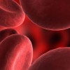 Anemia - globulos rojos