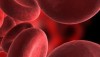 Anemia - globulos rojos
