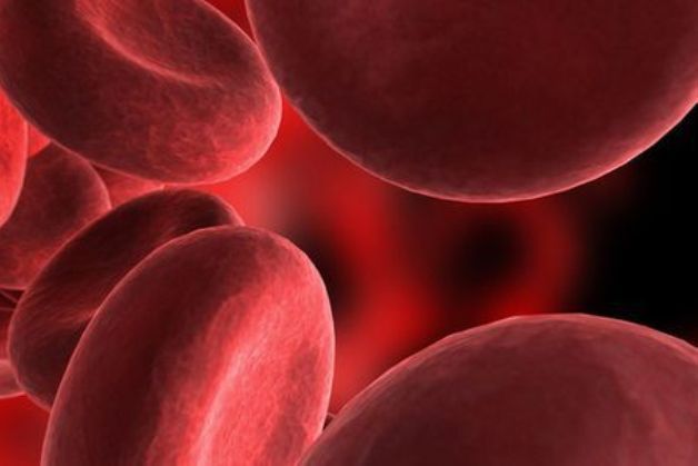Anemia - globulos rojos